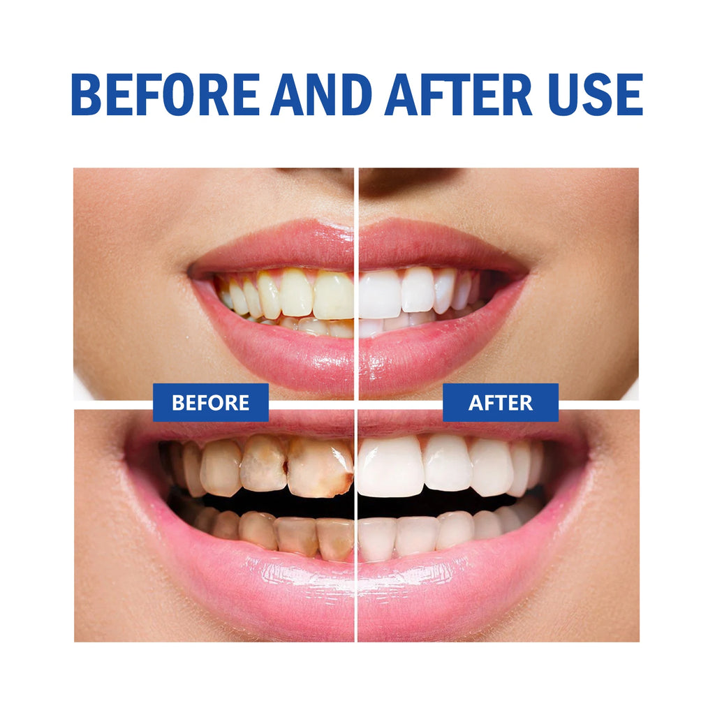 Whitening Teeth Mousse