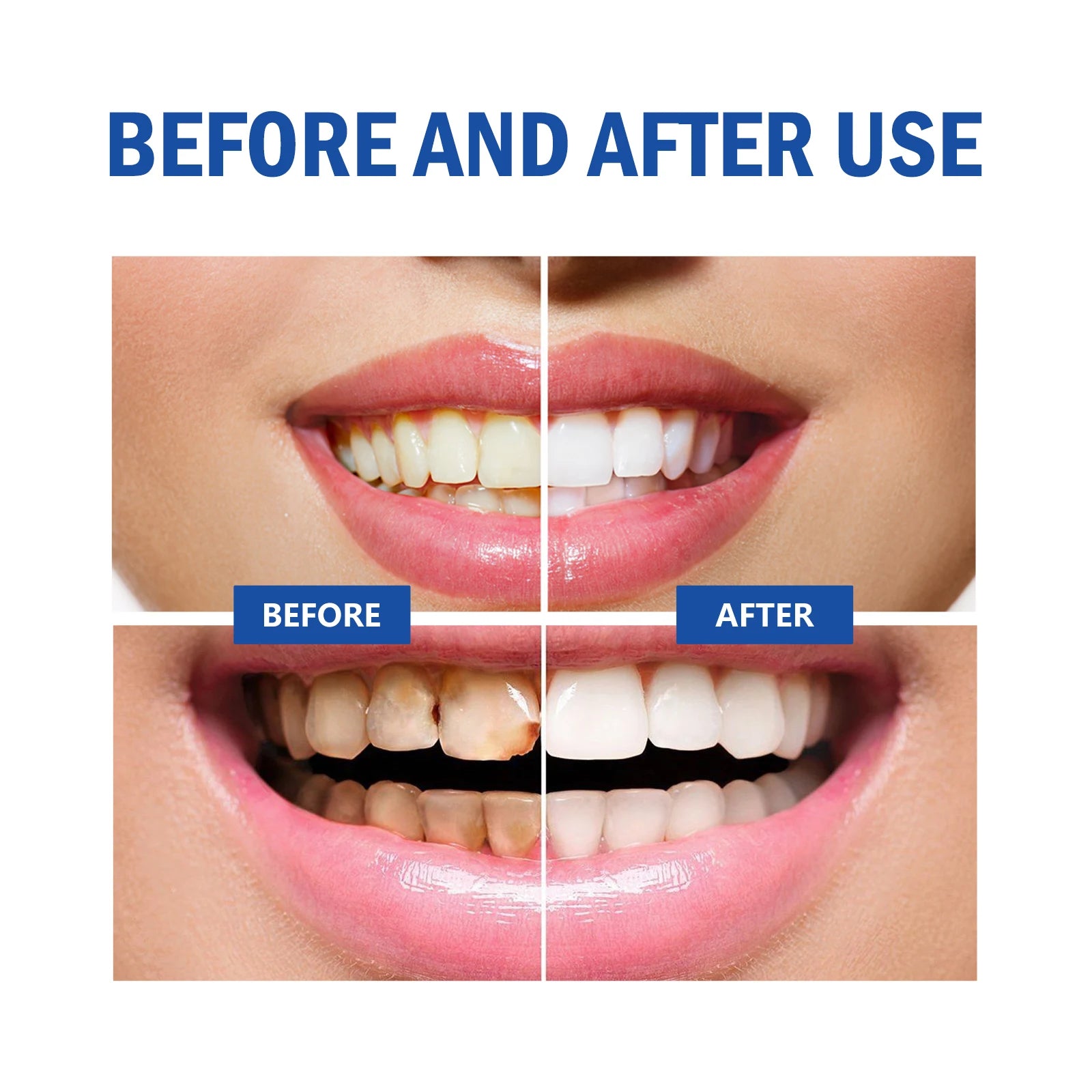 Whitening Teeth Mousse