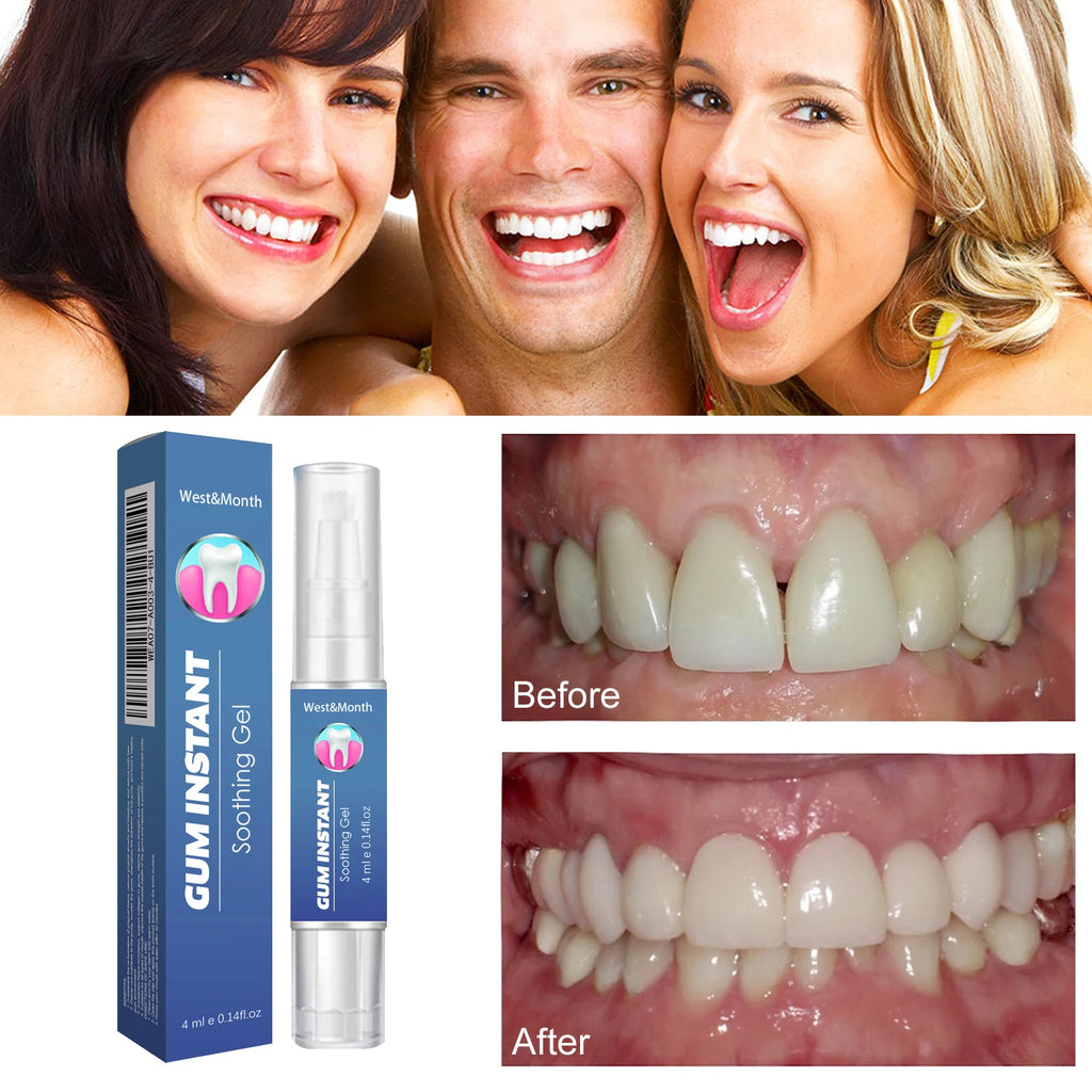 Soothing Teeth Gel