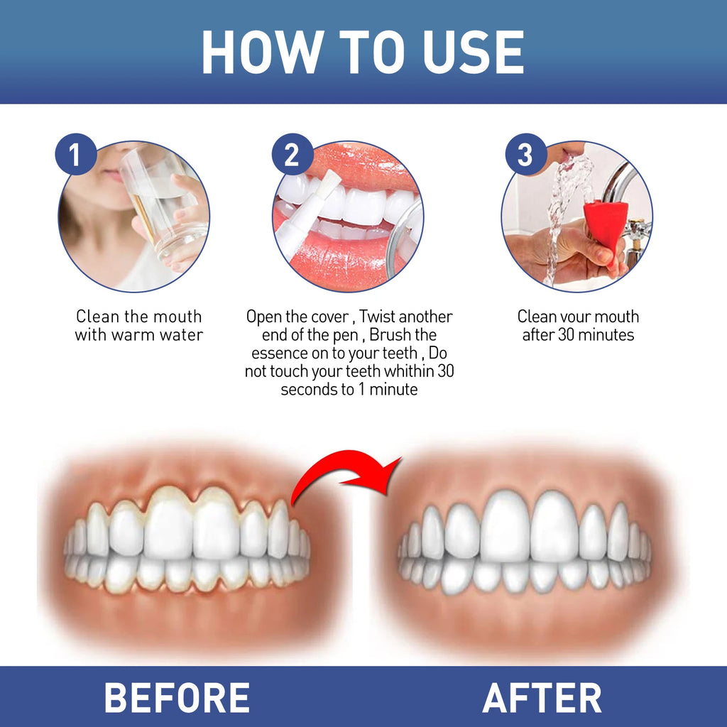 Soothing Teeth Gel