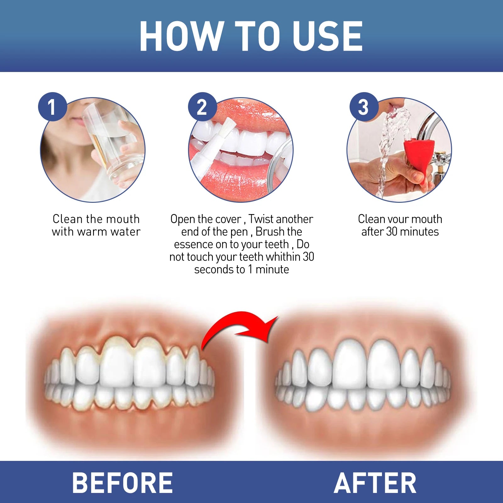 Soothing Teeth Gel