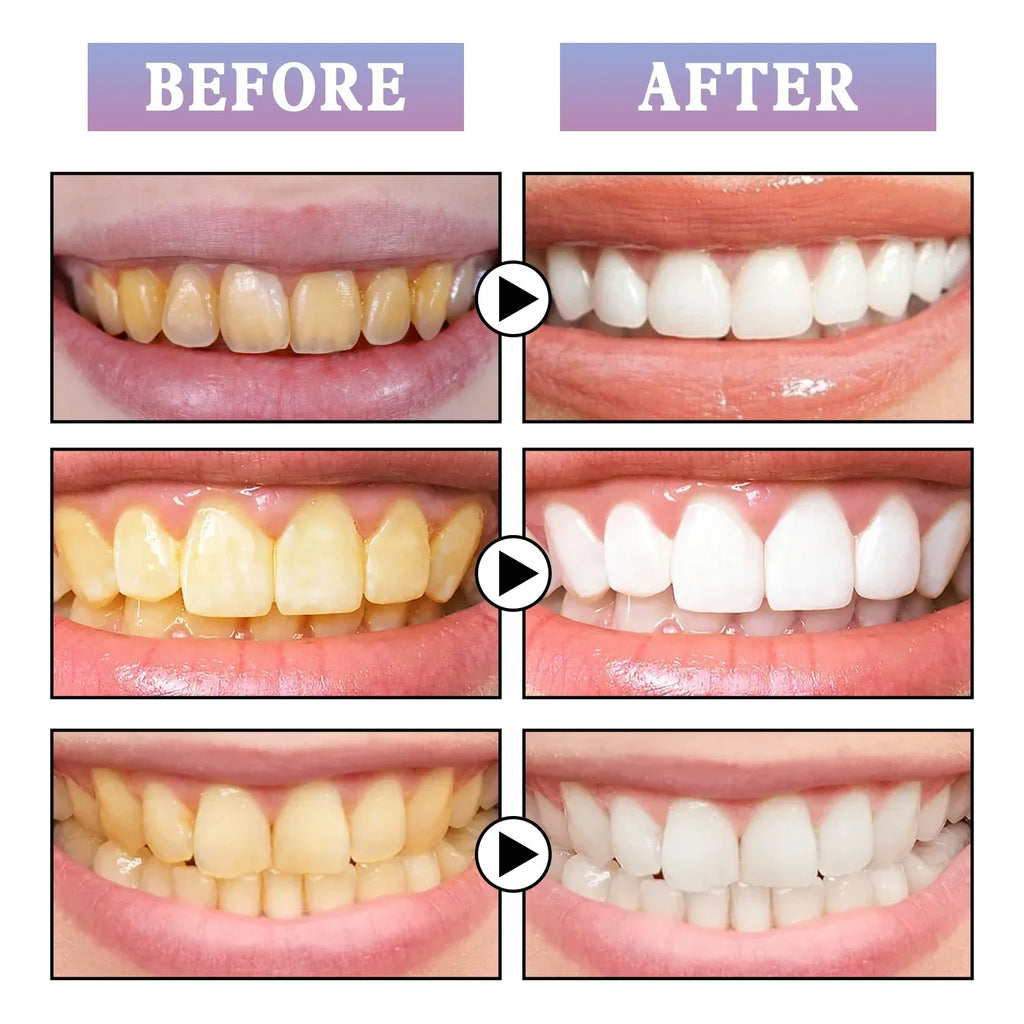 Instant Teeth Whitening Paint